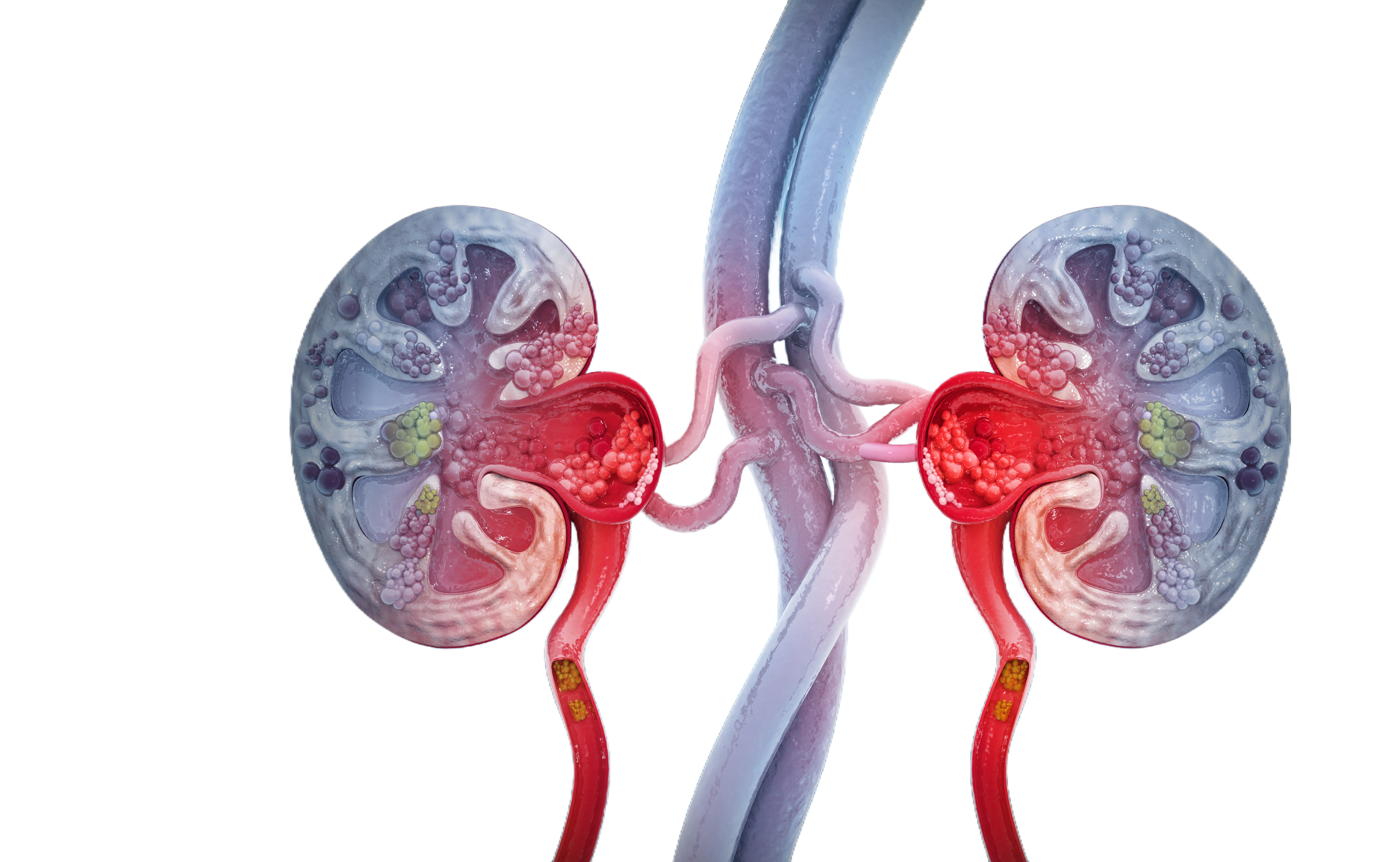 ΡΟΜΠΟΤΙΚΗ ΠΥΕΛΟΠΛΑΣΤΙΚΗ https://www.advancedurologyclinic.com/wp-content/uploads/2024/07/ΡΟΜΠΟΤΙΚΗ-ΠΥΕΛΟΠΛΑΣΤΙΚΗ.png