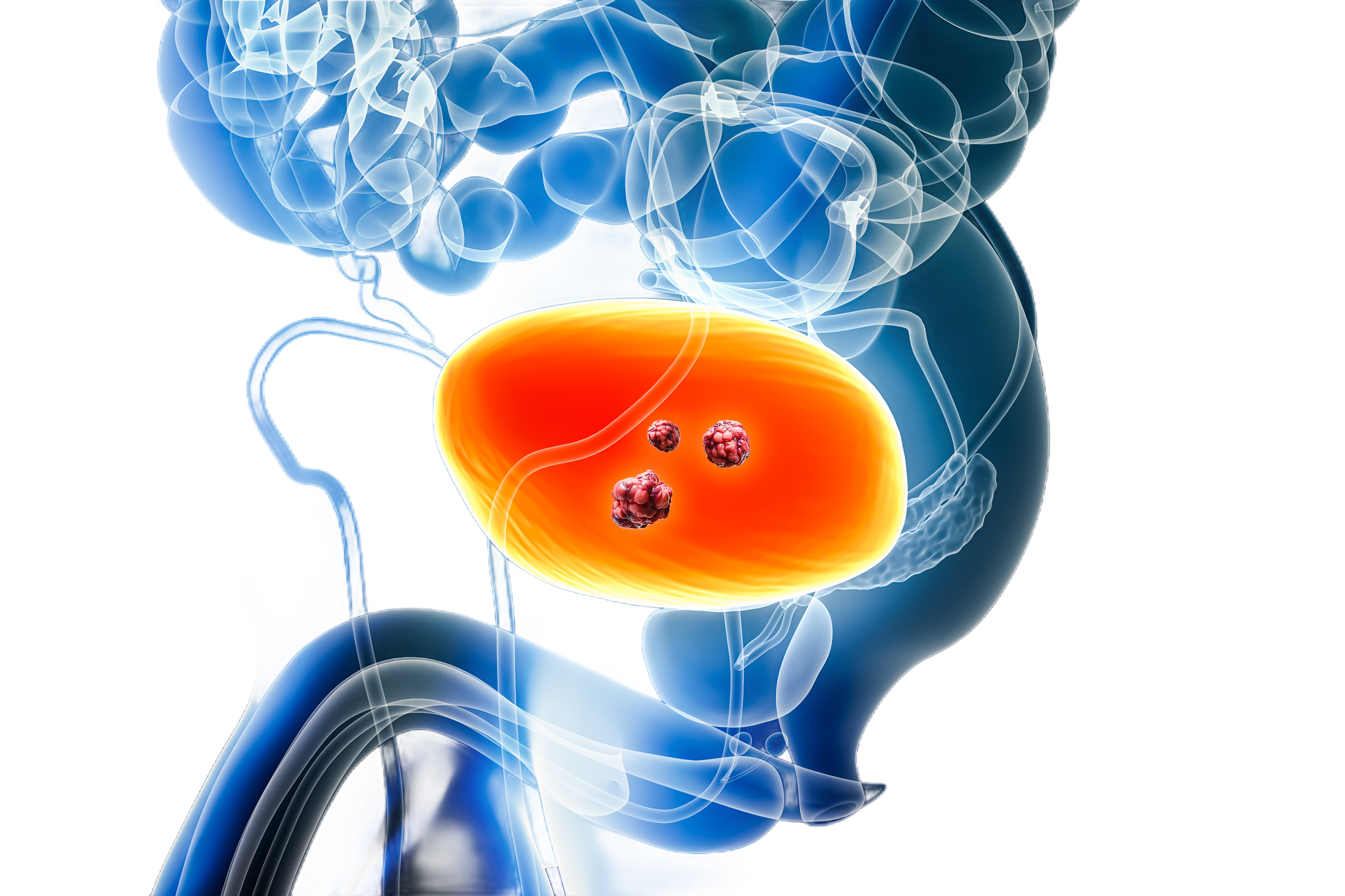 ΡΟΜΠΟΤΙΚΗ ΡΙΖΙΚΗ ΚΥΣΤΕΚΤΟΜΗ https://www.advancedurologyclinic.com/wp-content/uploads/2024/07/ΡΟΜΠΟΤΙΚΗ-ΡΙΖΙΚΗ-ΚΥΣΤΕΚΤΟΜΗ.png